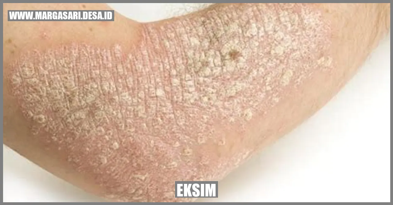 Eksim