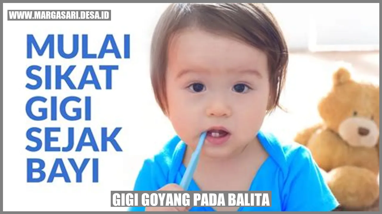 Gigi Goyang pada Balita