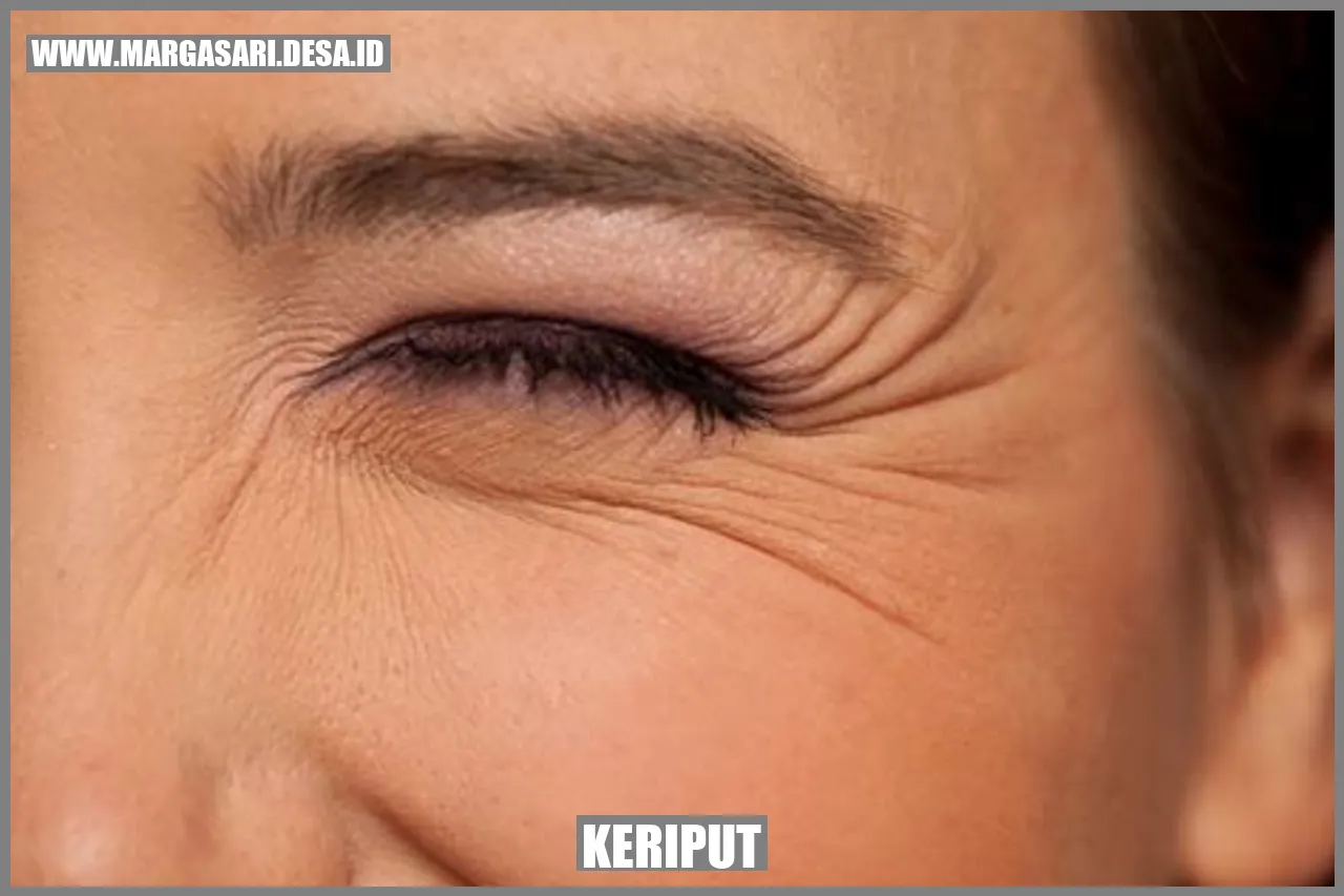Keriput