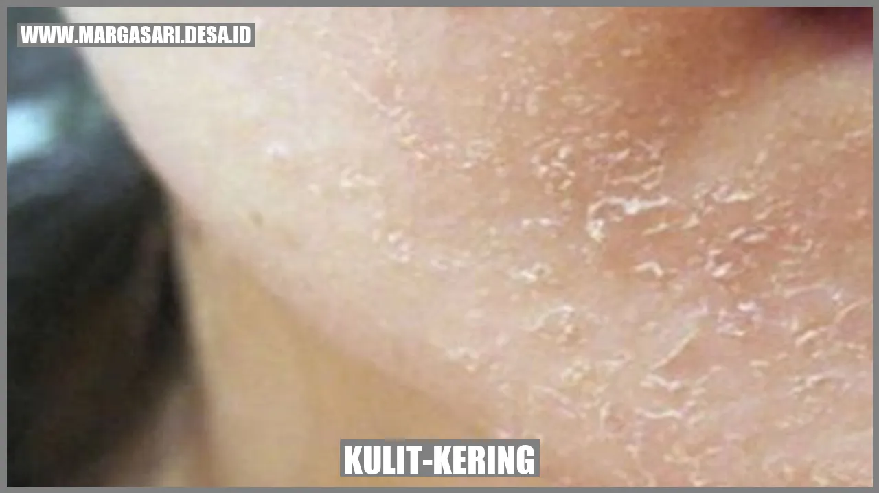 Kulit-kering