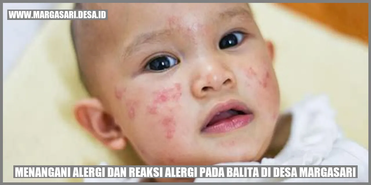 Menangani Alergi dan Reaksi Alergi pada Balita di Desa Margasari